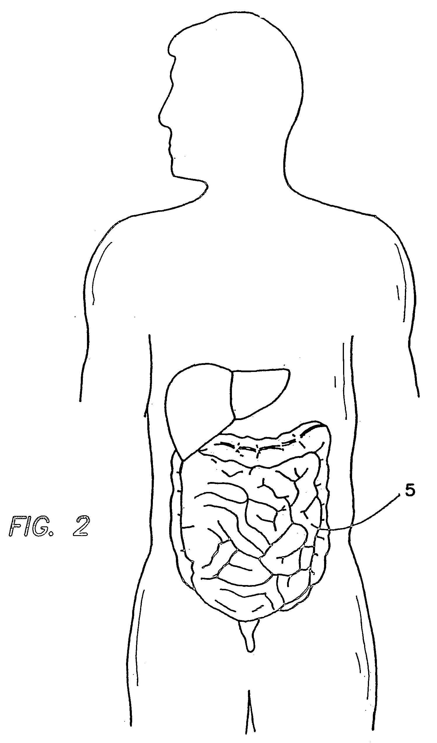 Internal tissue retractor