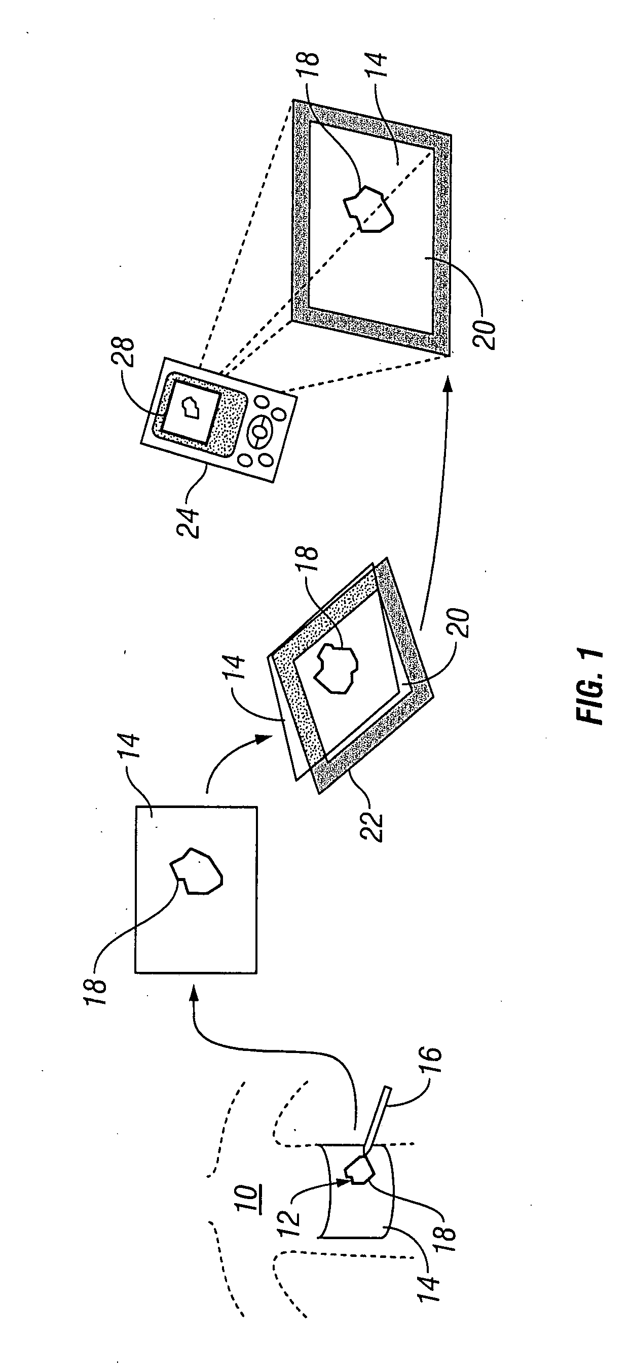 Systems and methods for wound area management