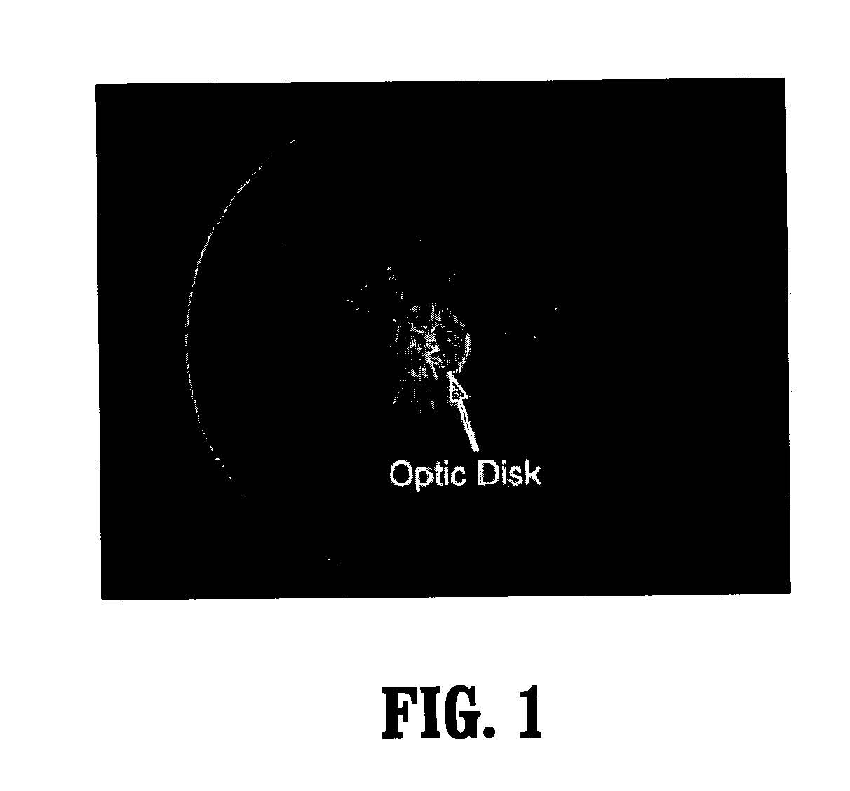 System and Method For Robust Optic Disk Detection In Retinal Images Using Vessel Structure And Radon Transform