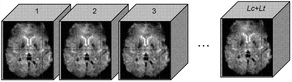 Cerebrum cognitive status recognition method based on cerebral function imaging