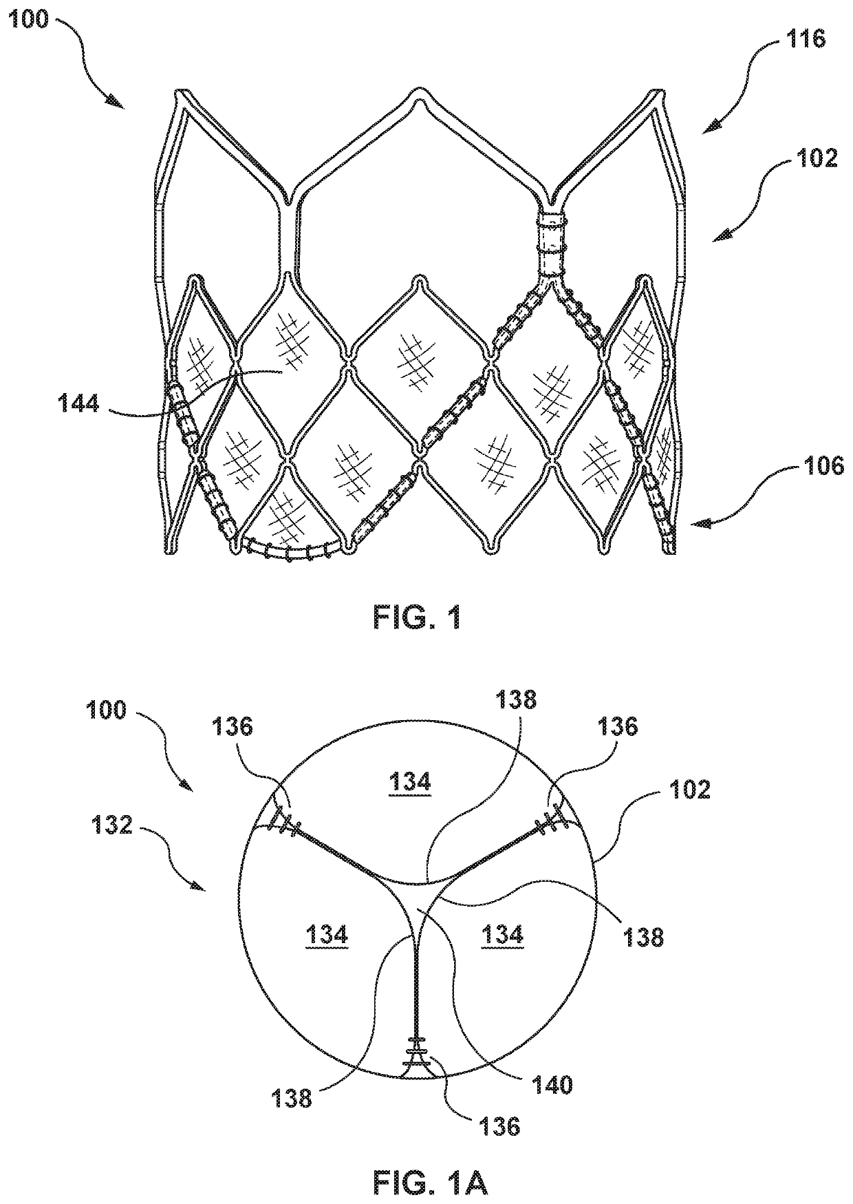 Balloon expandable frame for transcatheter implantation of a cardiac valve prosthesis