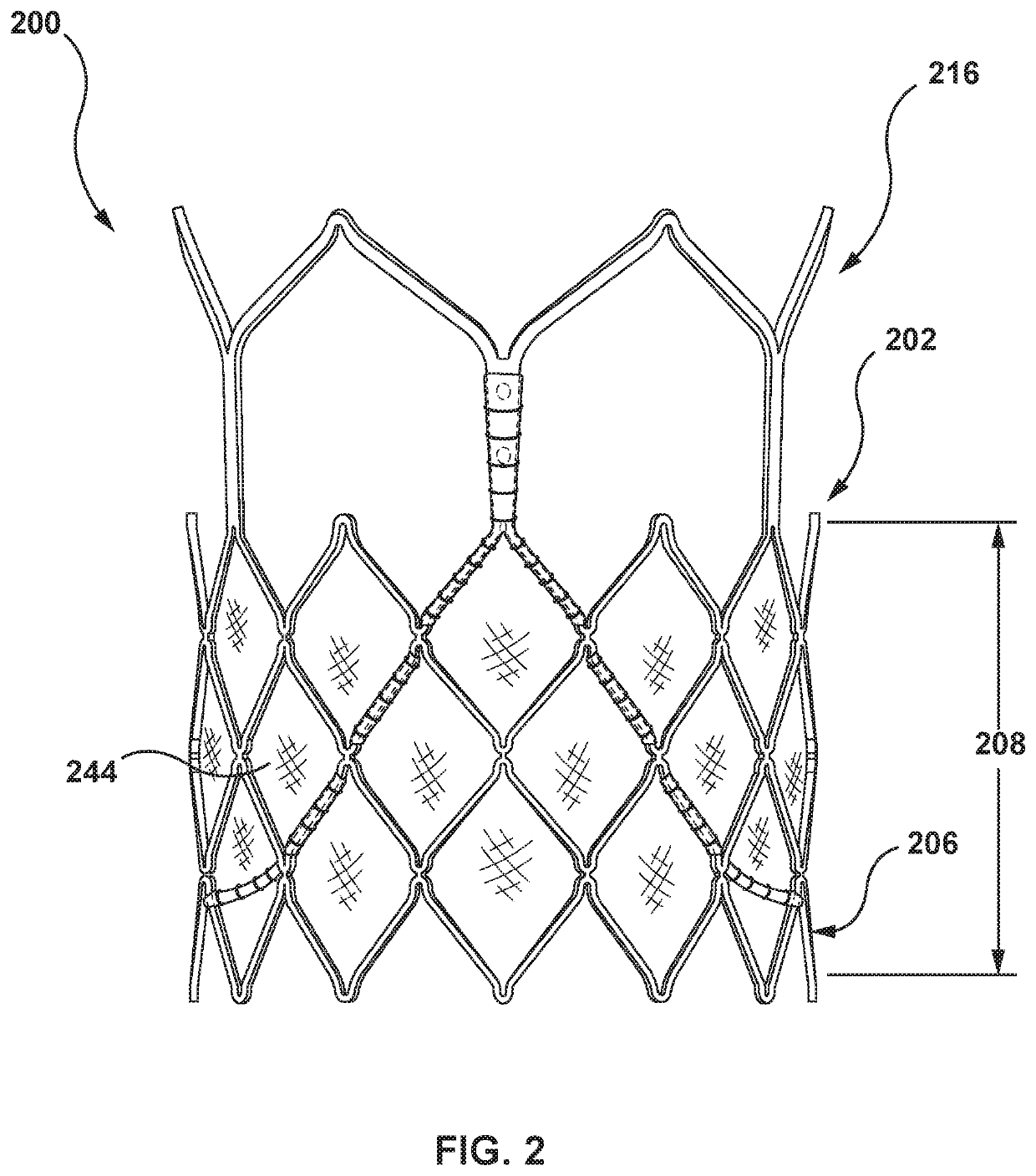 Balloon expandable frame for transcatheter implantation of a cardiac valve prosthesis
