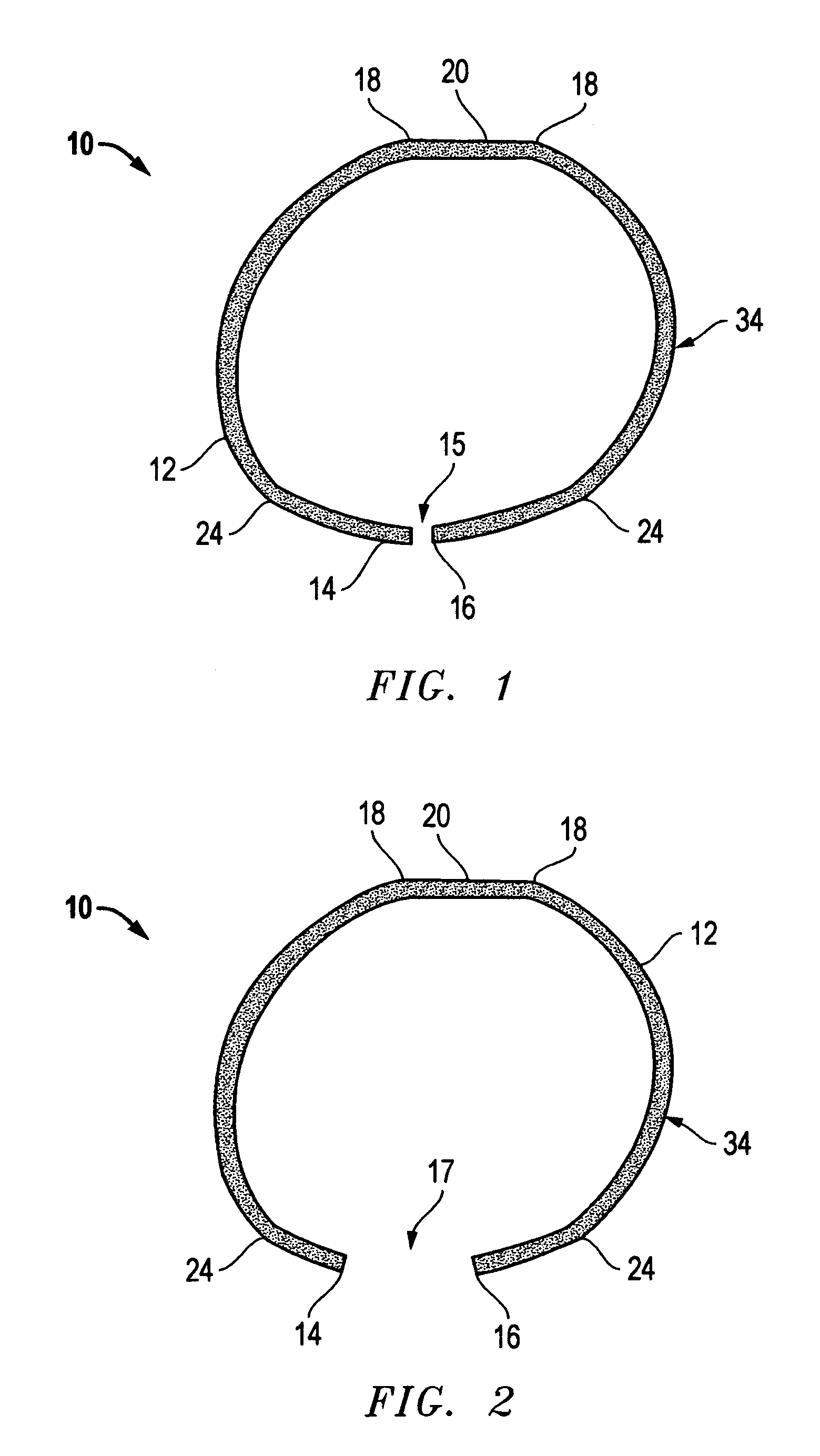 Wire broadhead apparatus and method