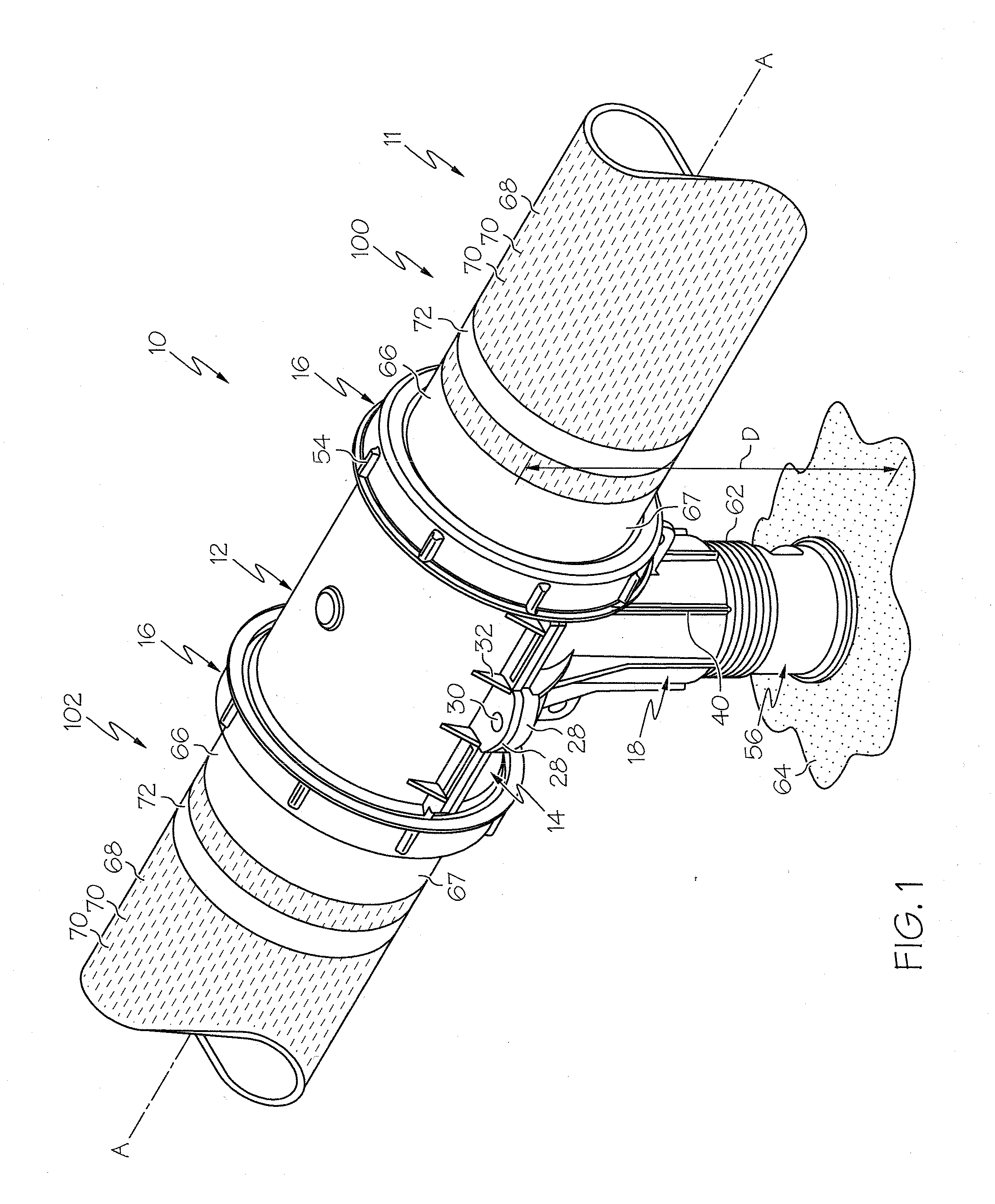 Modular diffuser body and aeration system
