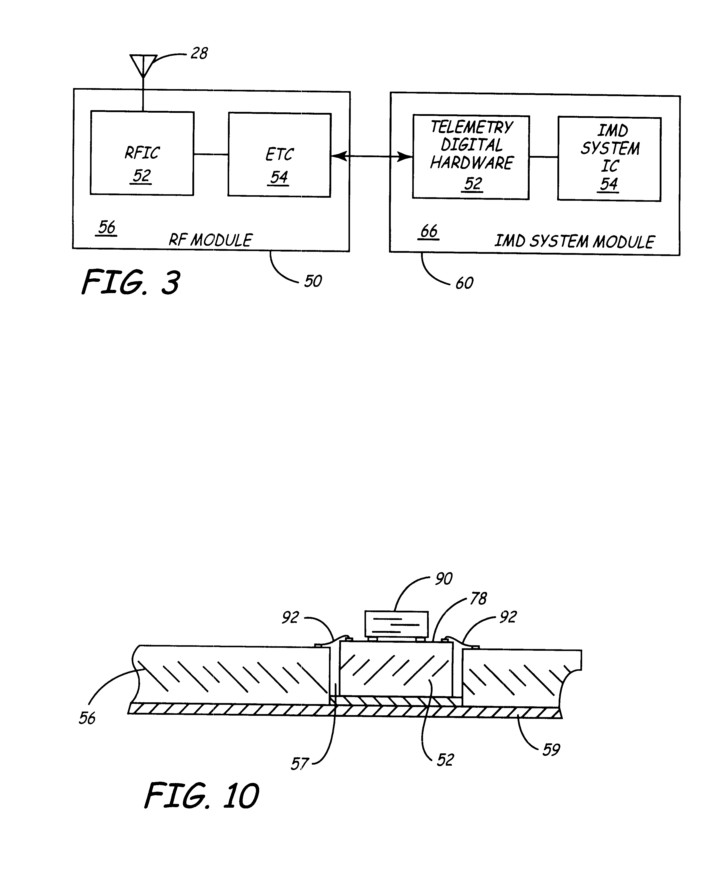 Implantable medical device incorporating miniaturized circuit module