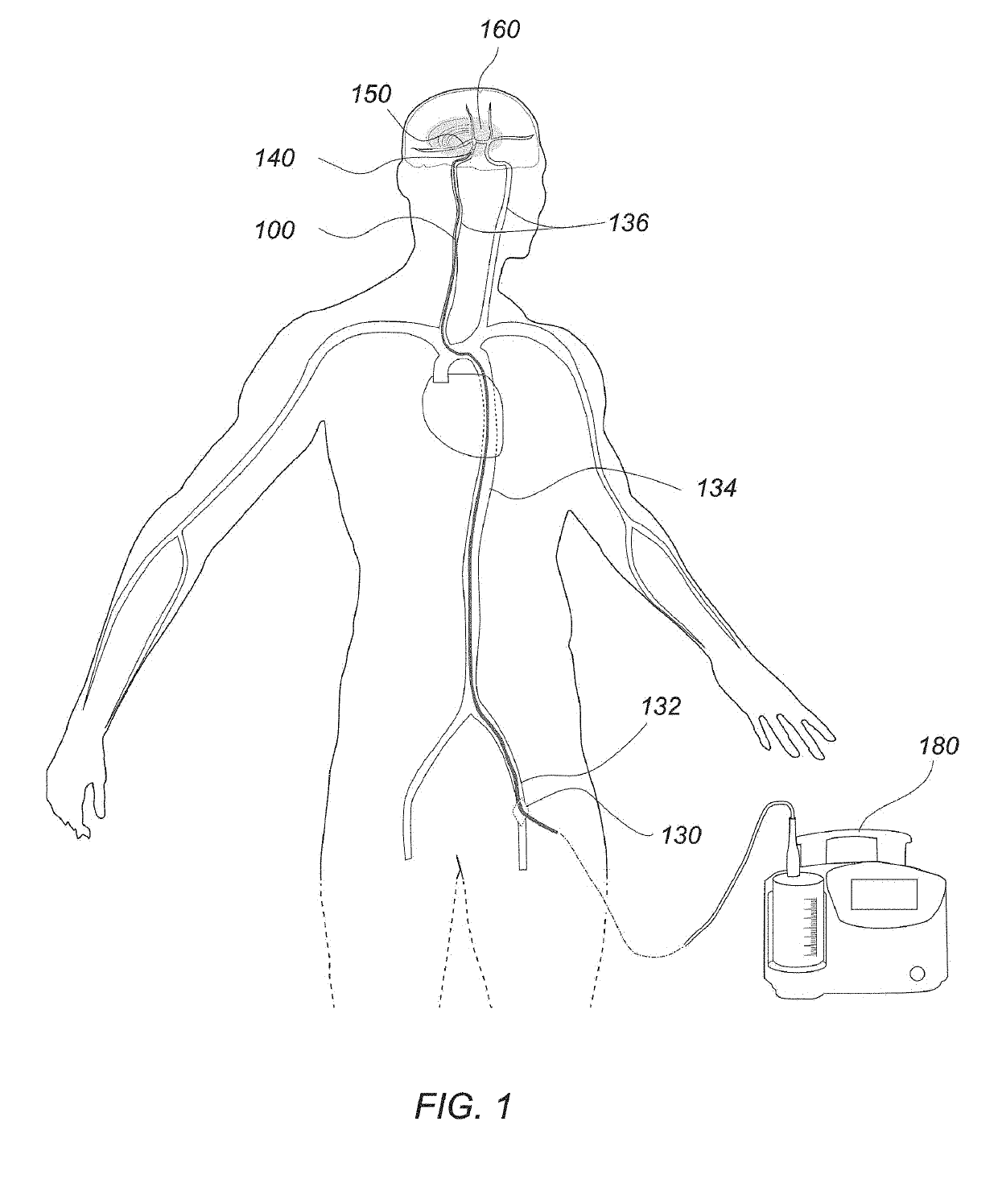 Post-conditioning suction catheter apparatus and methods