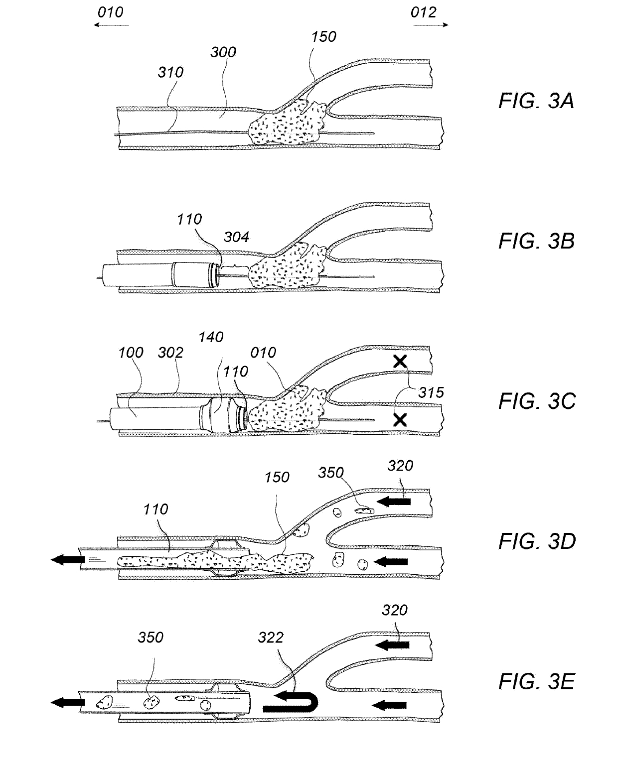 Post-conditioning suction catheter apparatus and methods