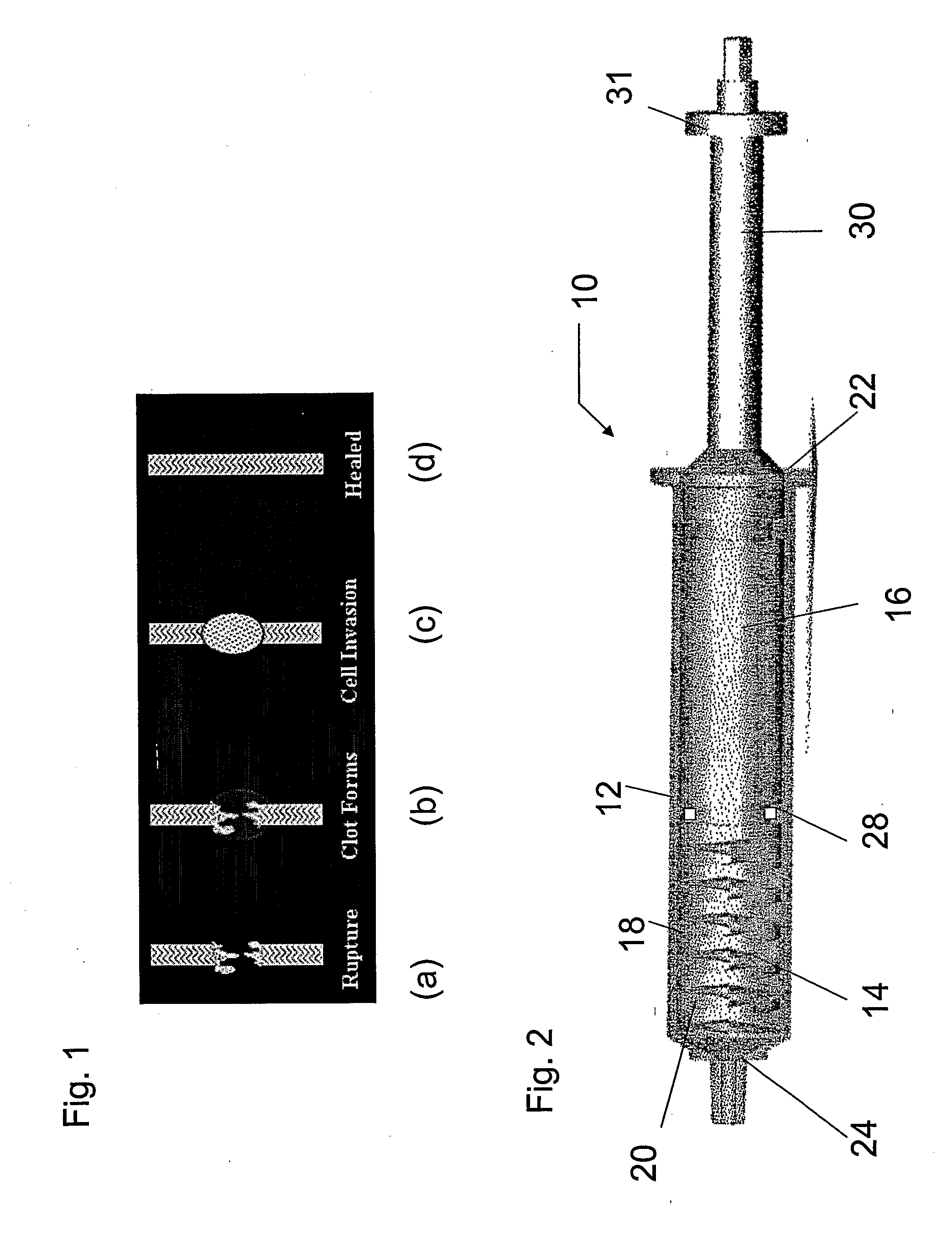 Device for Mixing and Delivering Fluids for Tissue Repair