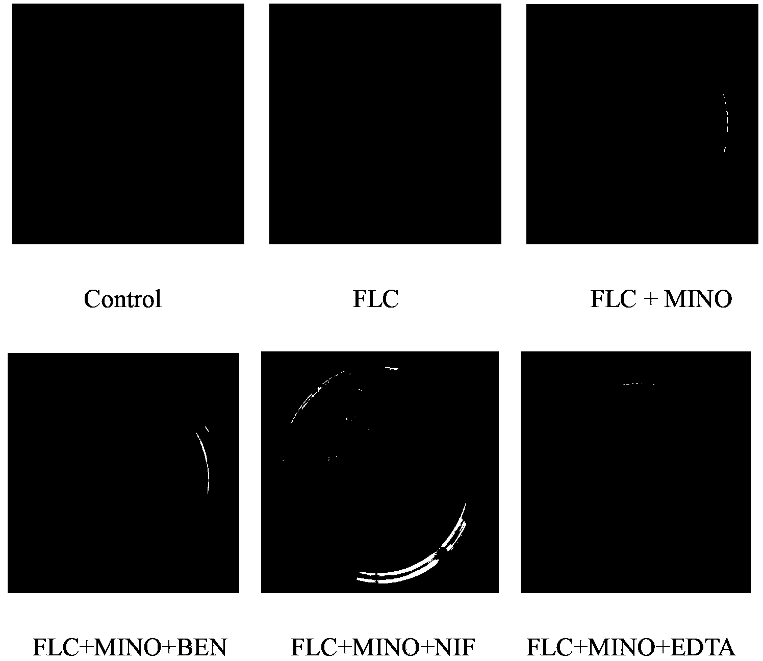 Application of combination of tetracycline medicine and fluconazole in preparation of antifungal product, and product thereof