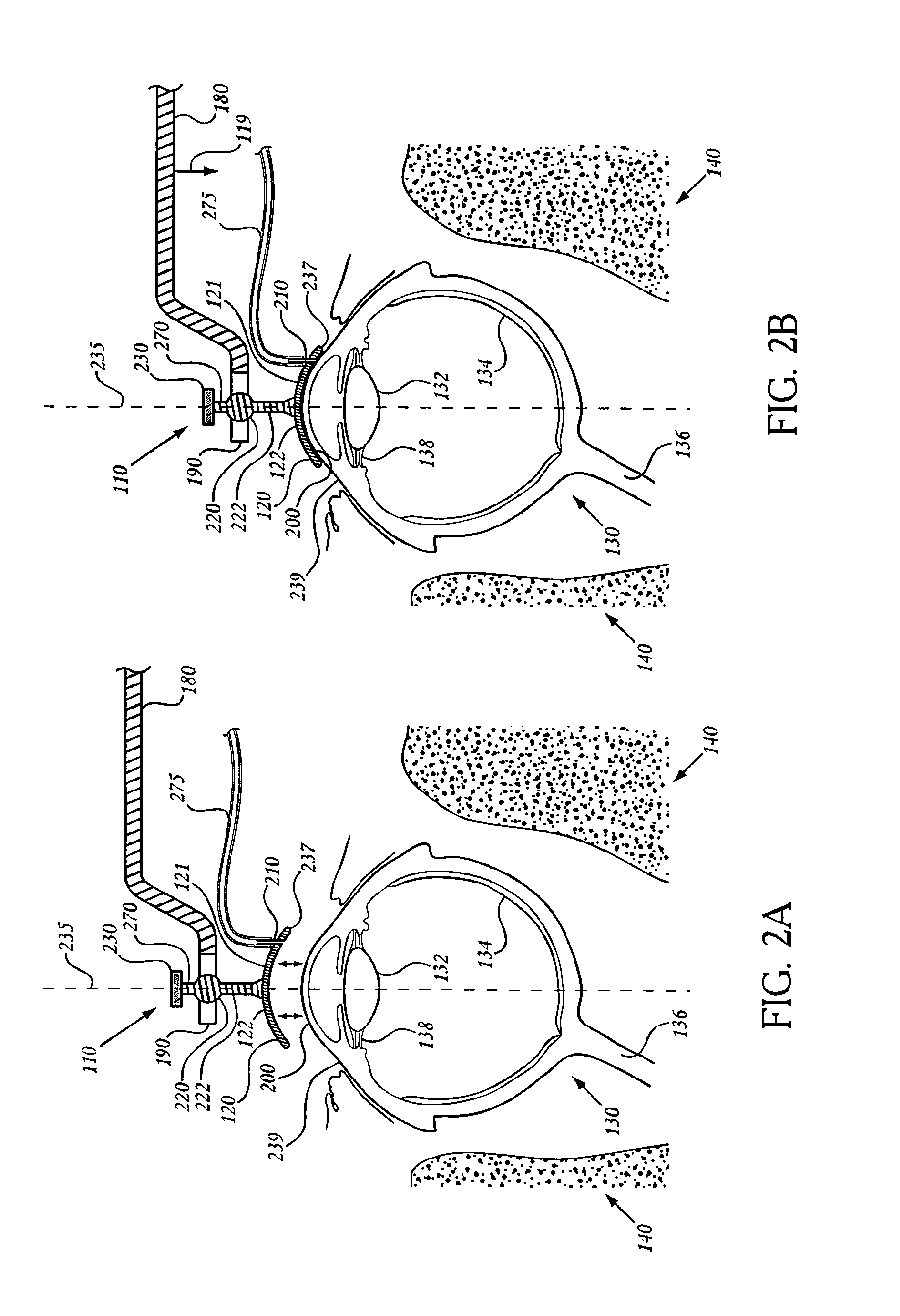 System and method for performing an ocular irradiation procedure