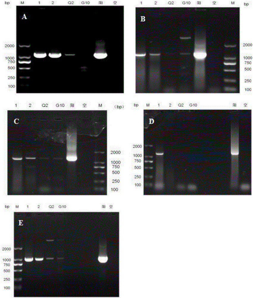 Specific detection primer for swine toxoplasmosis and detection kit