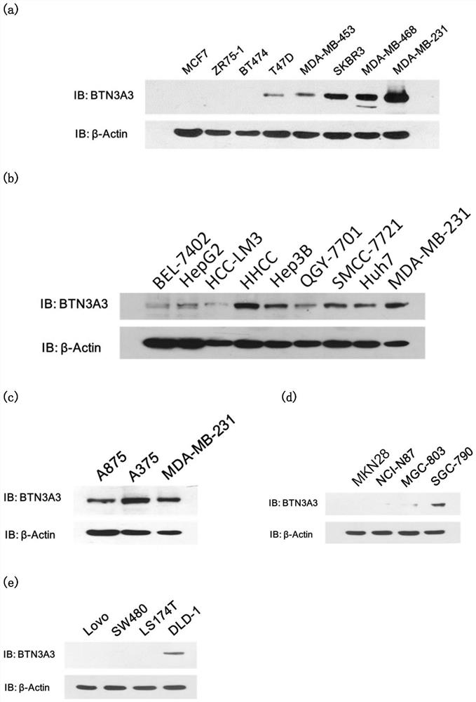 A target for tumor therapy and its application