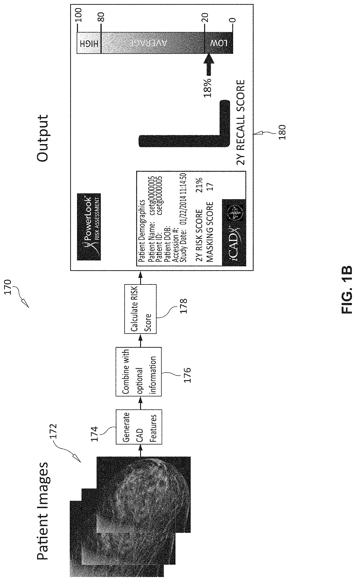 System and method for assessing breast cancer risk using imagery