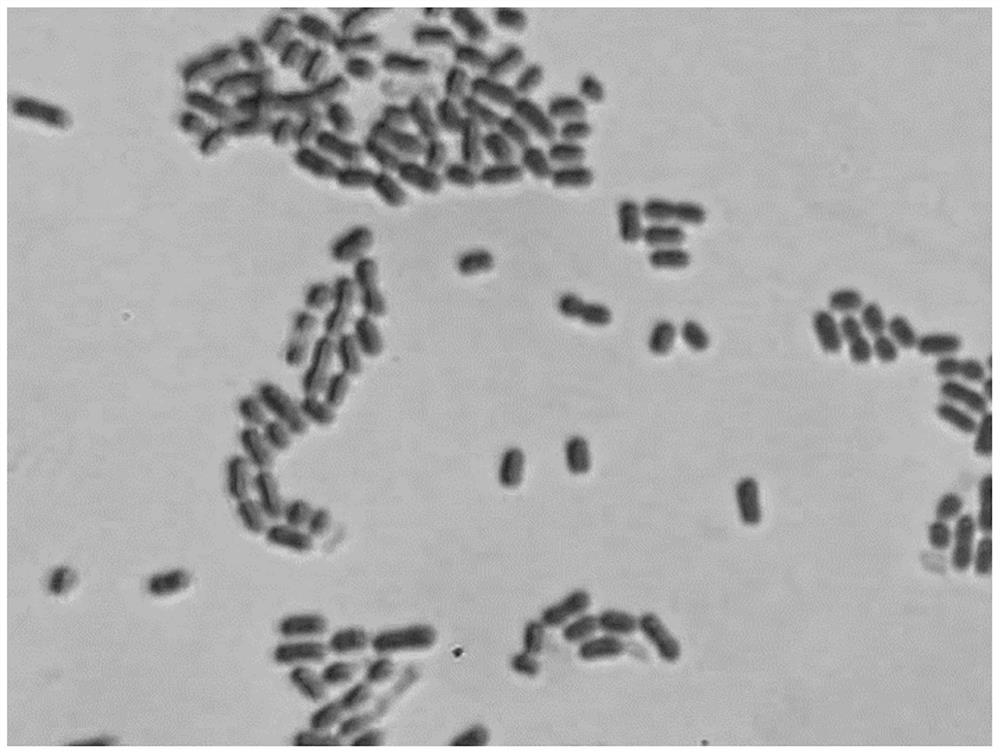 Anti-helicobacter pylori infection lactobacillus reuteri and application thereof