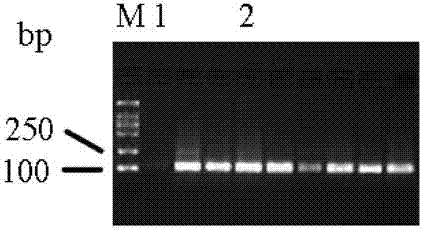 FOXP3 (forkhead/winged helix transcription factor 3) gene methylation detection method based on bisulfite sequencing