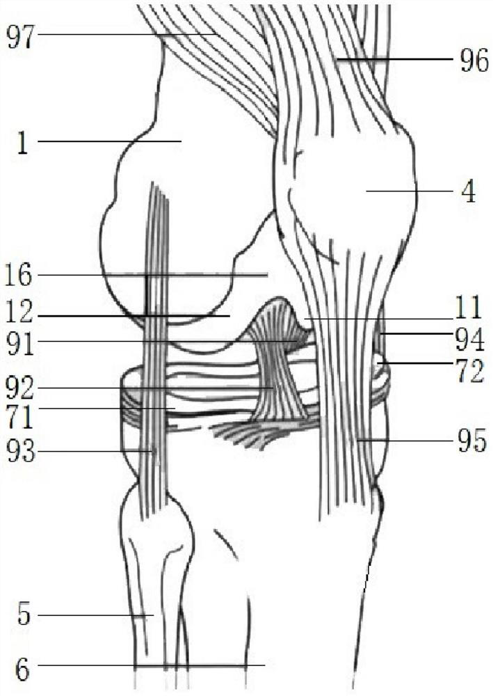 Anatomical knee joint tibial plateau pad with retained posterior cruciate ligaments