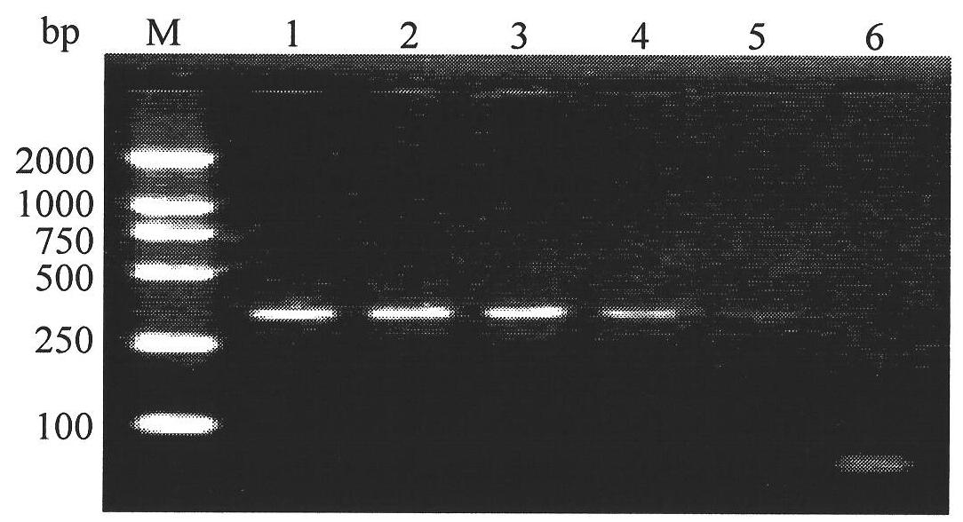 Specific COI primer, detection method and reagent kit of Frankliniella occidentalis