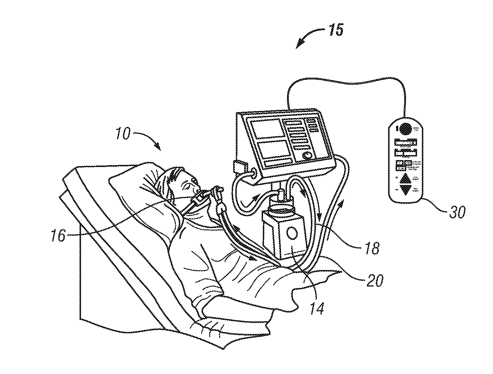Patient-controlled aerosol administration
