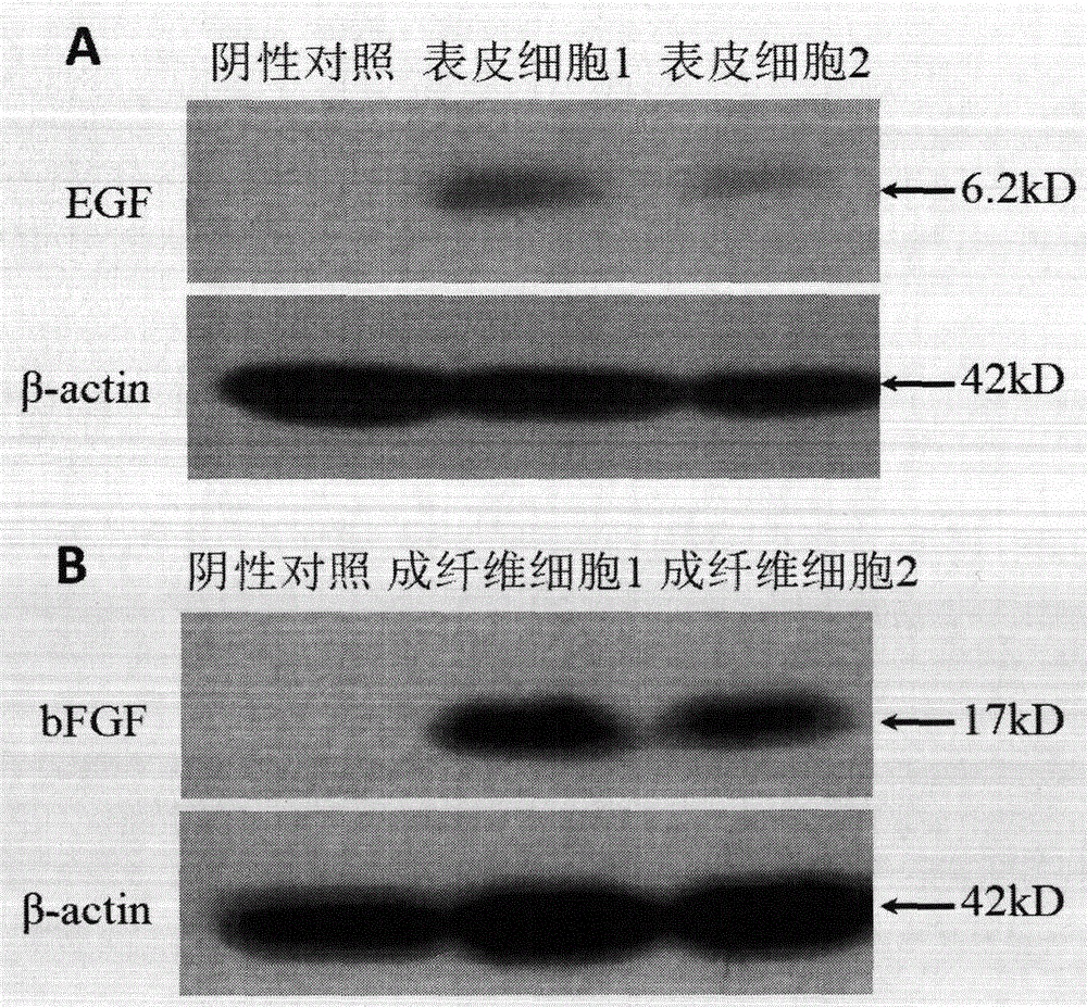 Simultaneous autologous epidermic cell and fibrocyte preparation method and biological cosmetic product thereof