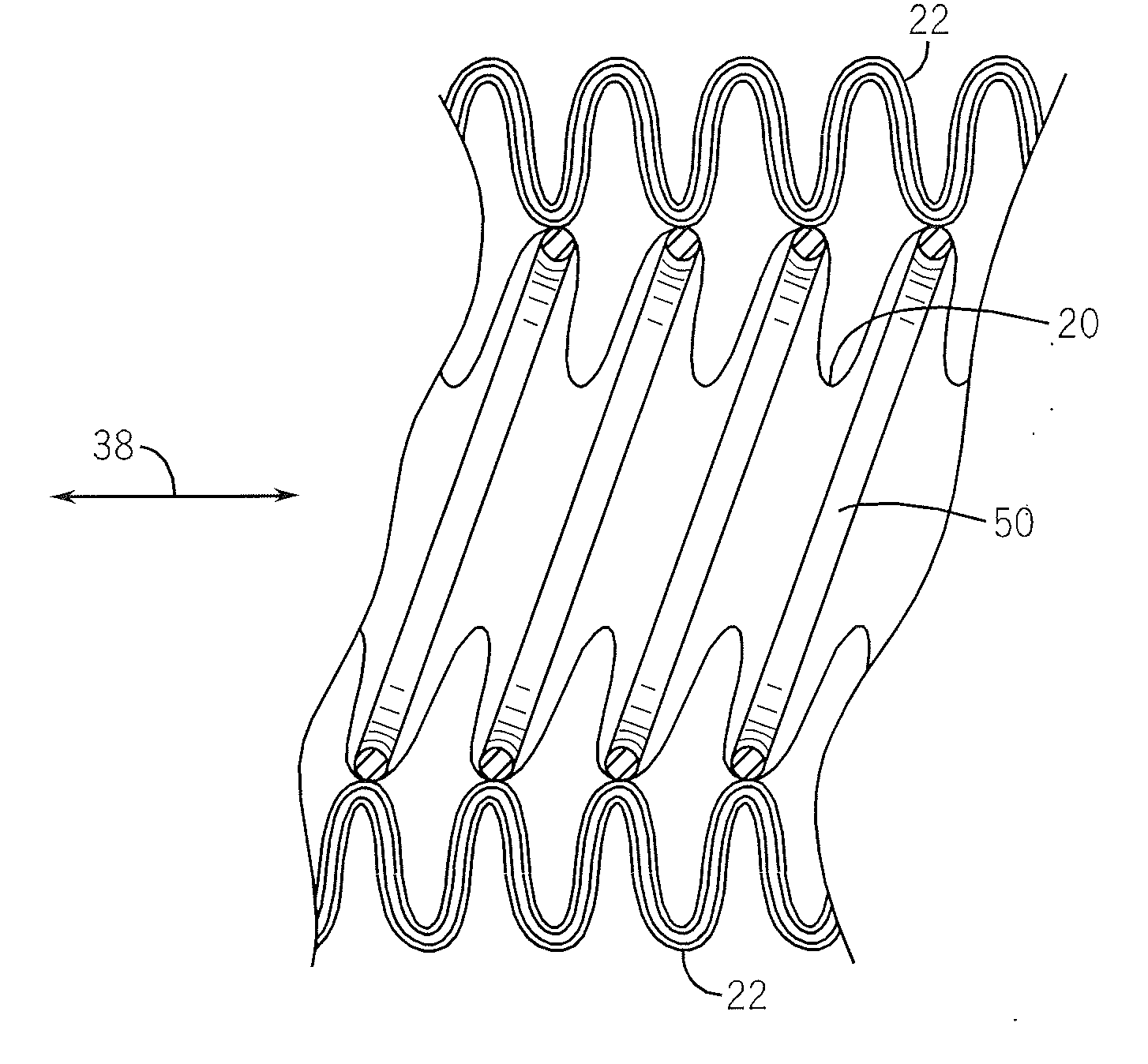 Irrigation system with inflatable suction hose