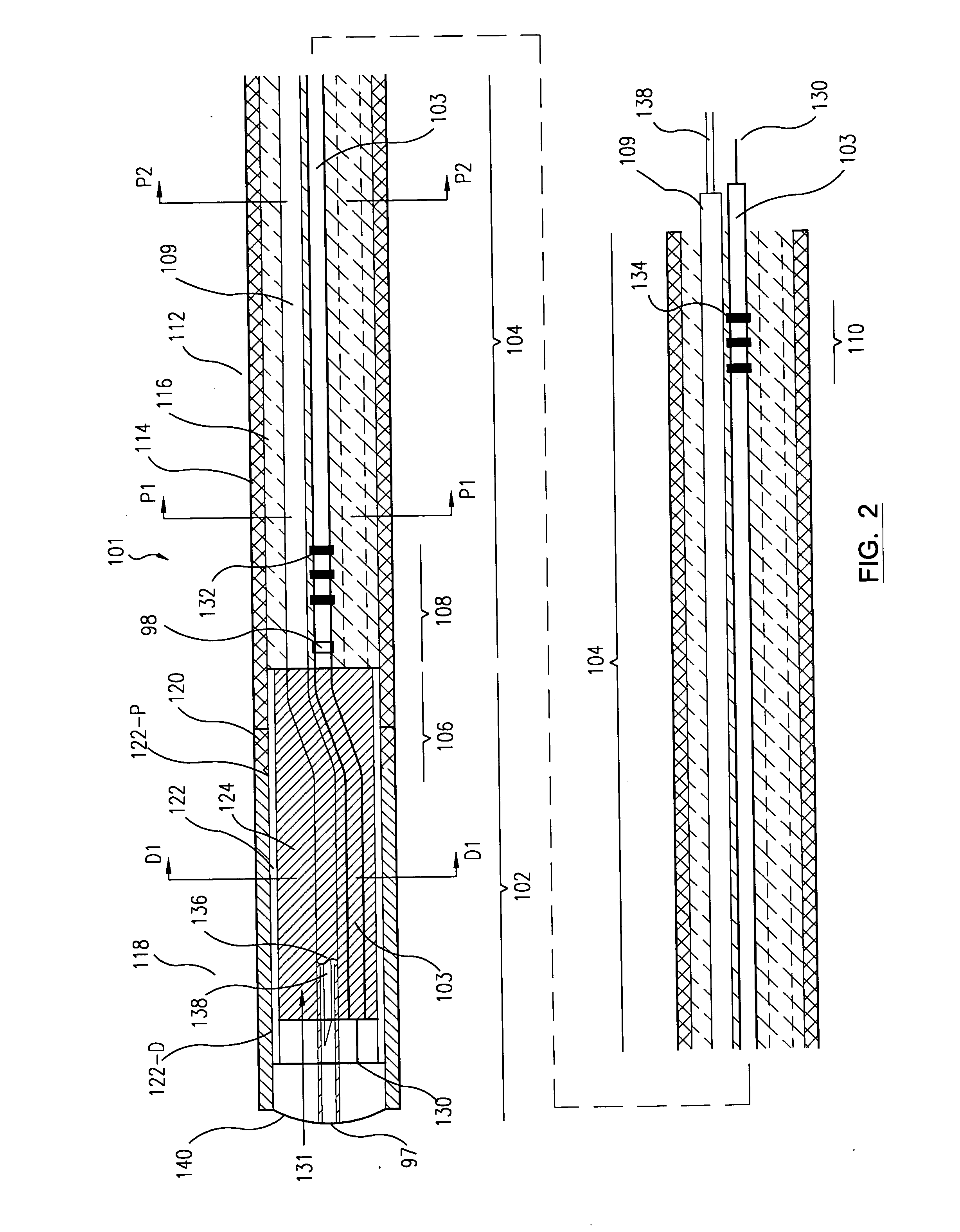 Deflectable catheter assembly and method of making same