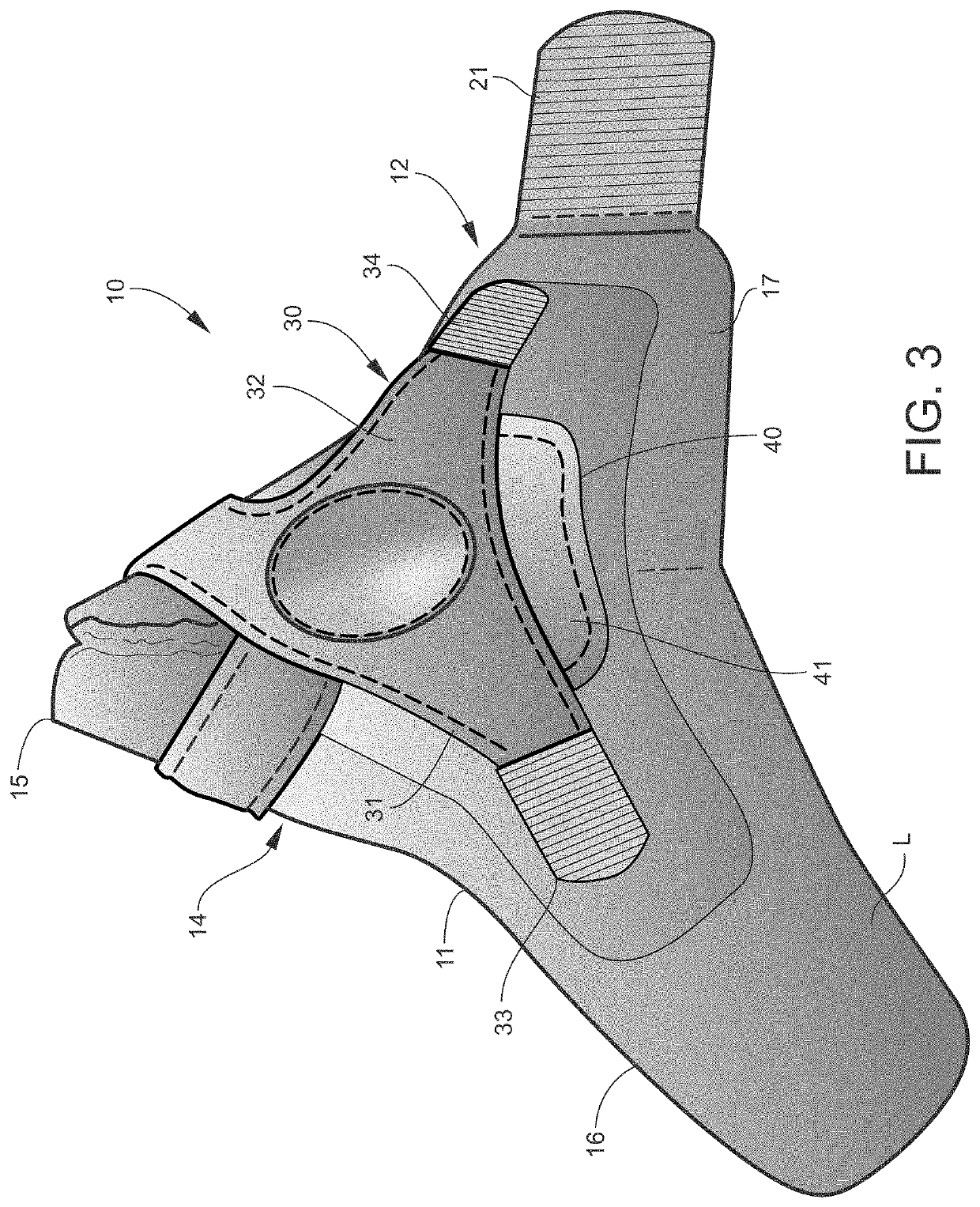 Orthopedic thumb splint and method for stabilizing the trapeziometacarpal joint of a user
