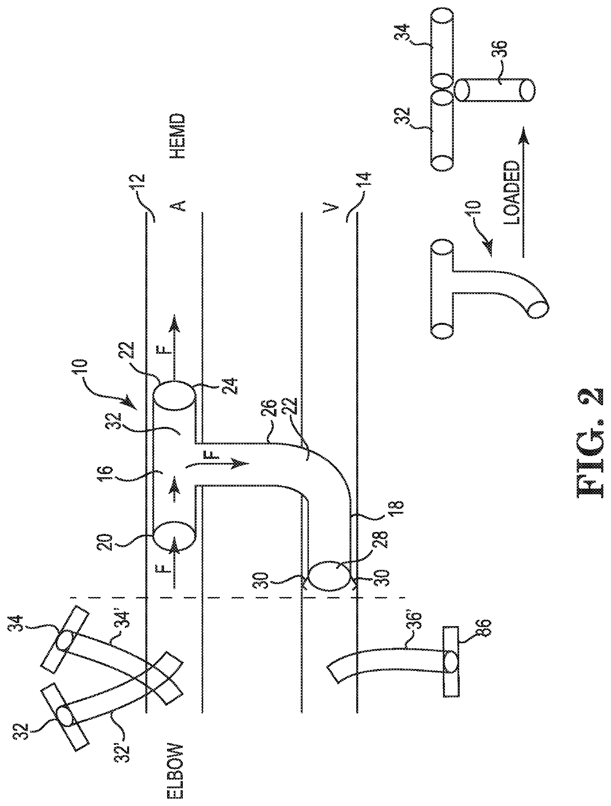 One piece anastomotic connector