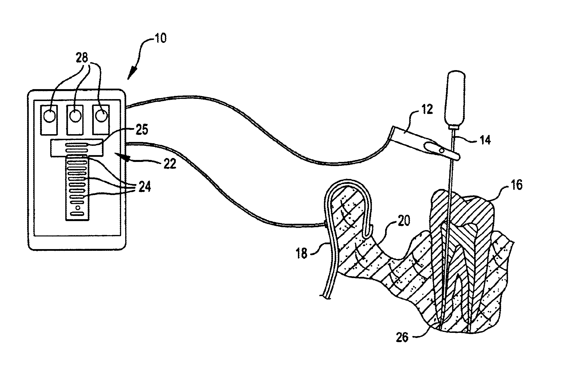 Systems and methods for locating a tooth's apical foramen