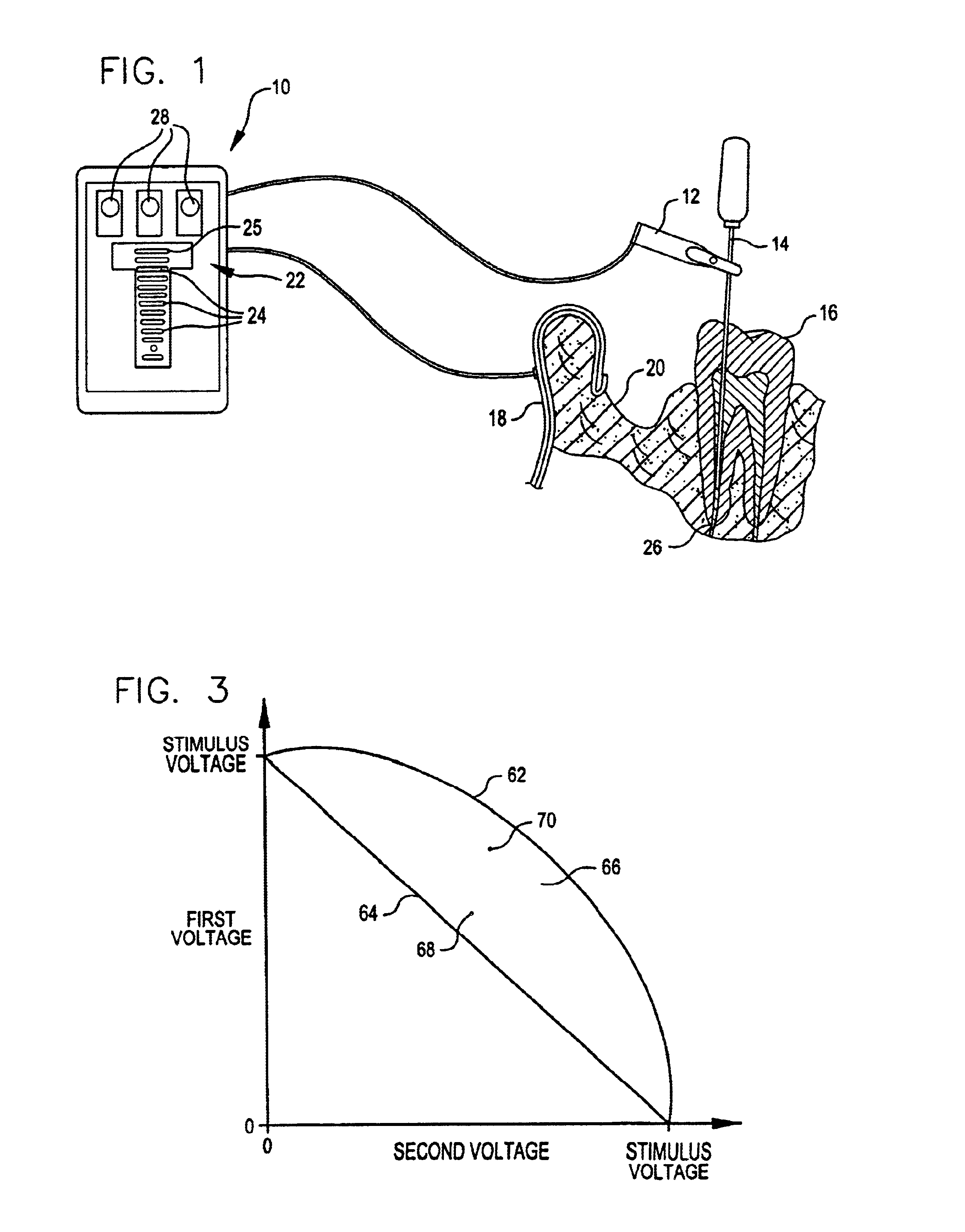 Systems and methods for locating a tooth's apical foramen