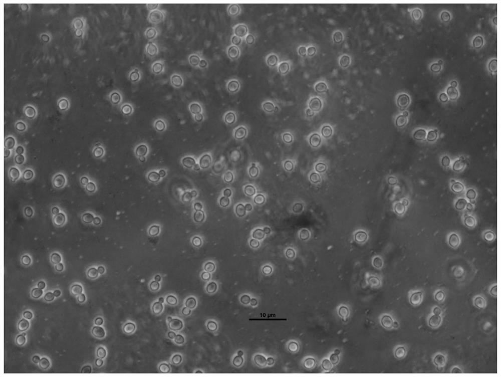 A strain of Saccharomyces cerevisiae with low fusel oil production and its application
