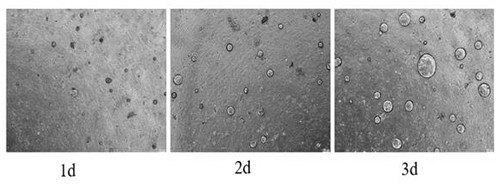 A kind of in vitro construction method and application of liver organoids
