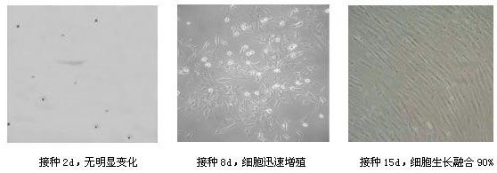 Synovial mesenchymal stem cell and PRP combined preparation for repairing articular cartilage injury as well as preparation method and application thereof