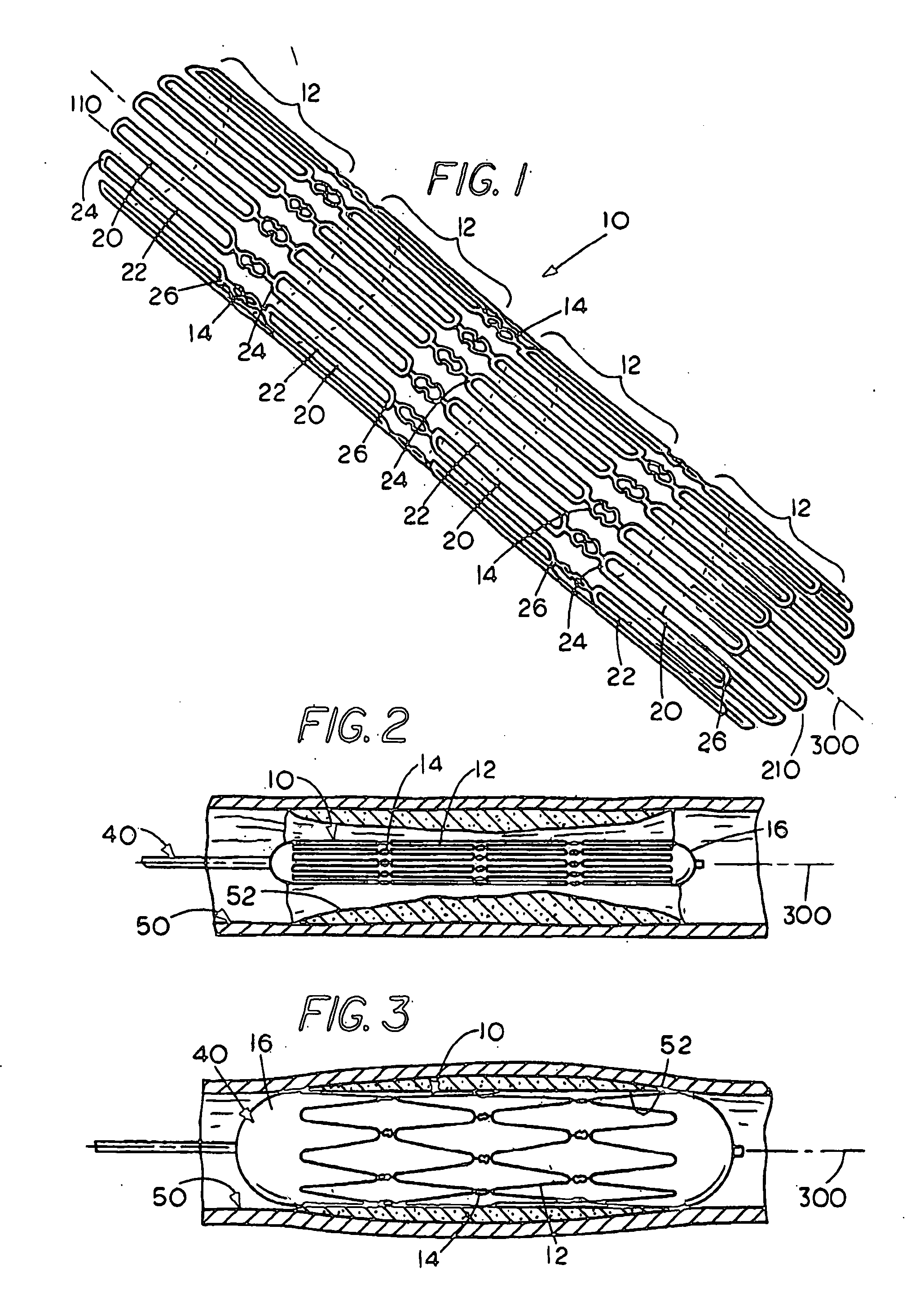 Flexible cells for axially interconnecting stent components