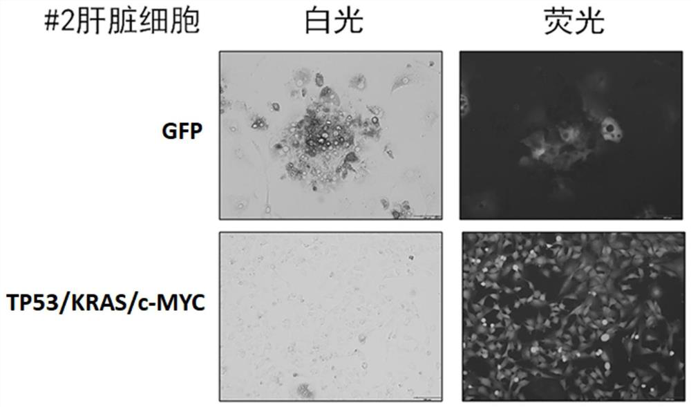 Gene combination for inducing hepatocytes into live cancer cells and application of gene combination