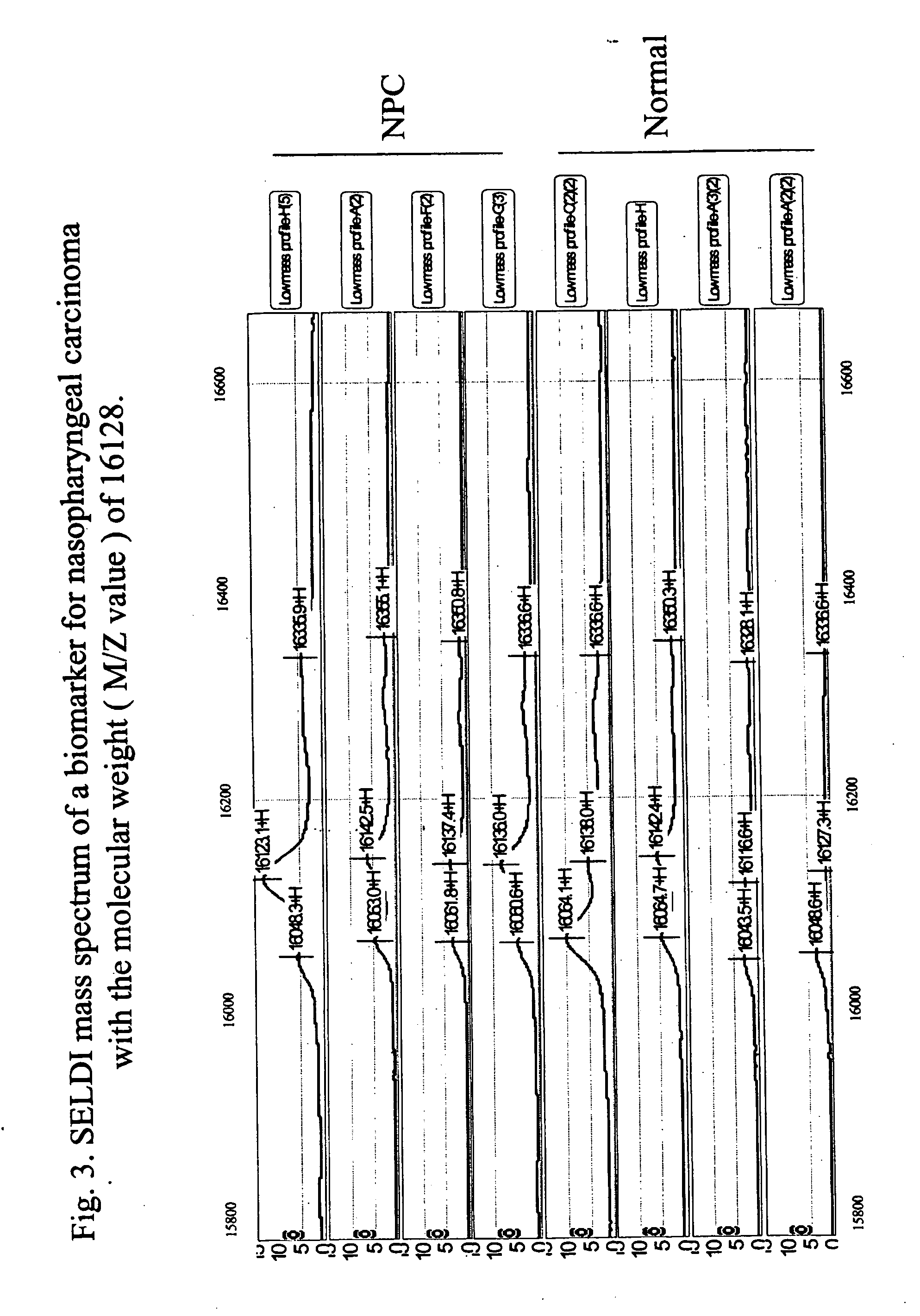 Methods and compositions for detection of nasopharyngeal carcinoma