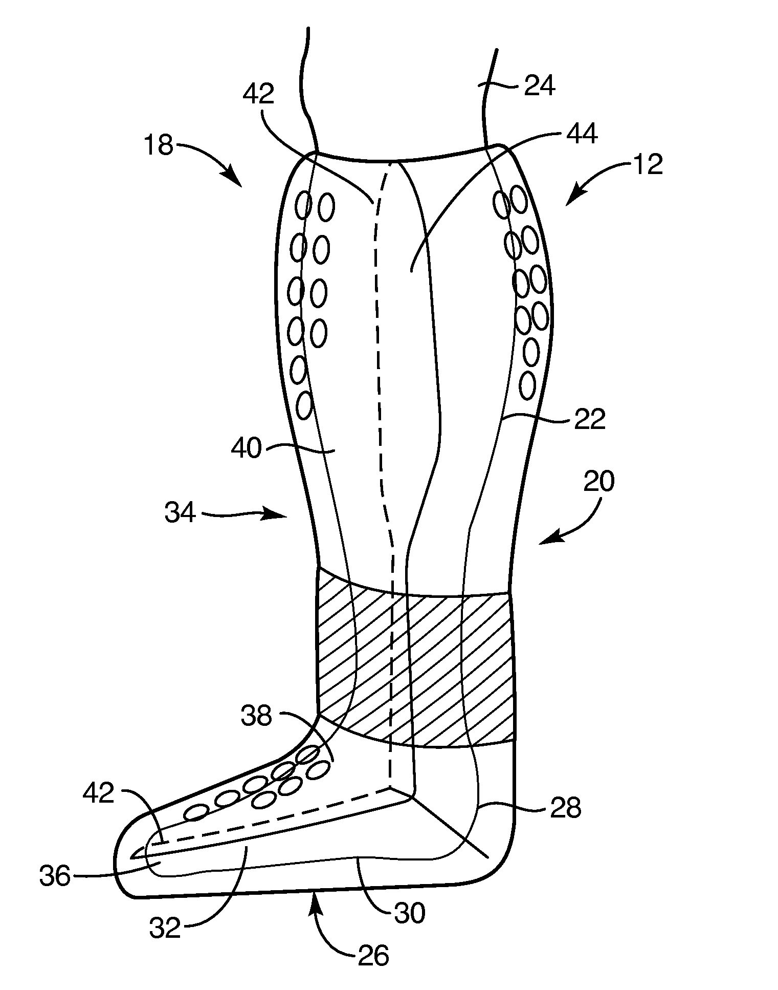 Systems and methods for providing a shear reduction system for an orthopedic cast