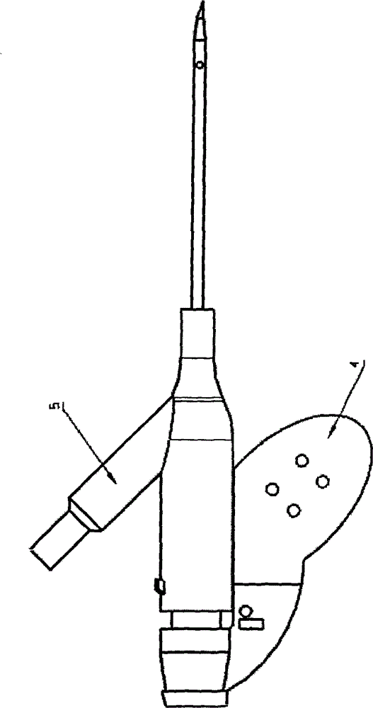 Puncture And Drainage Needle For Blood Purification - Eureka | Patsnap