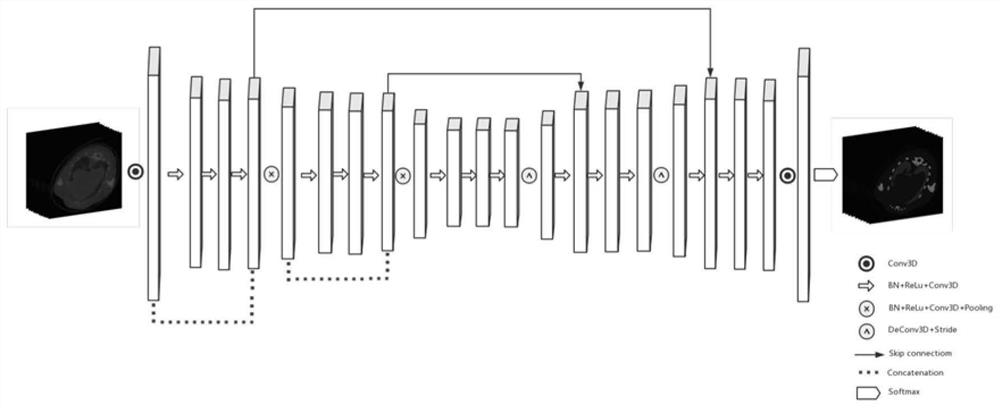 Energy spectrum CT image domain material identification method based on 3D full convolutional neural network