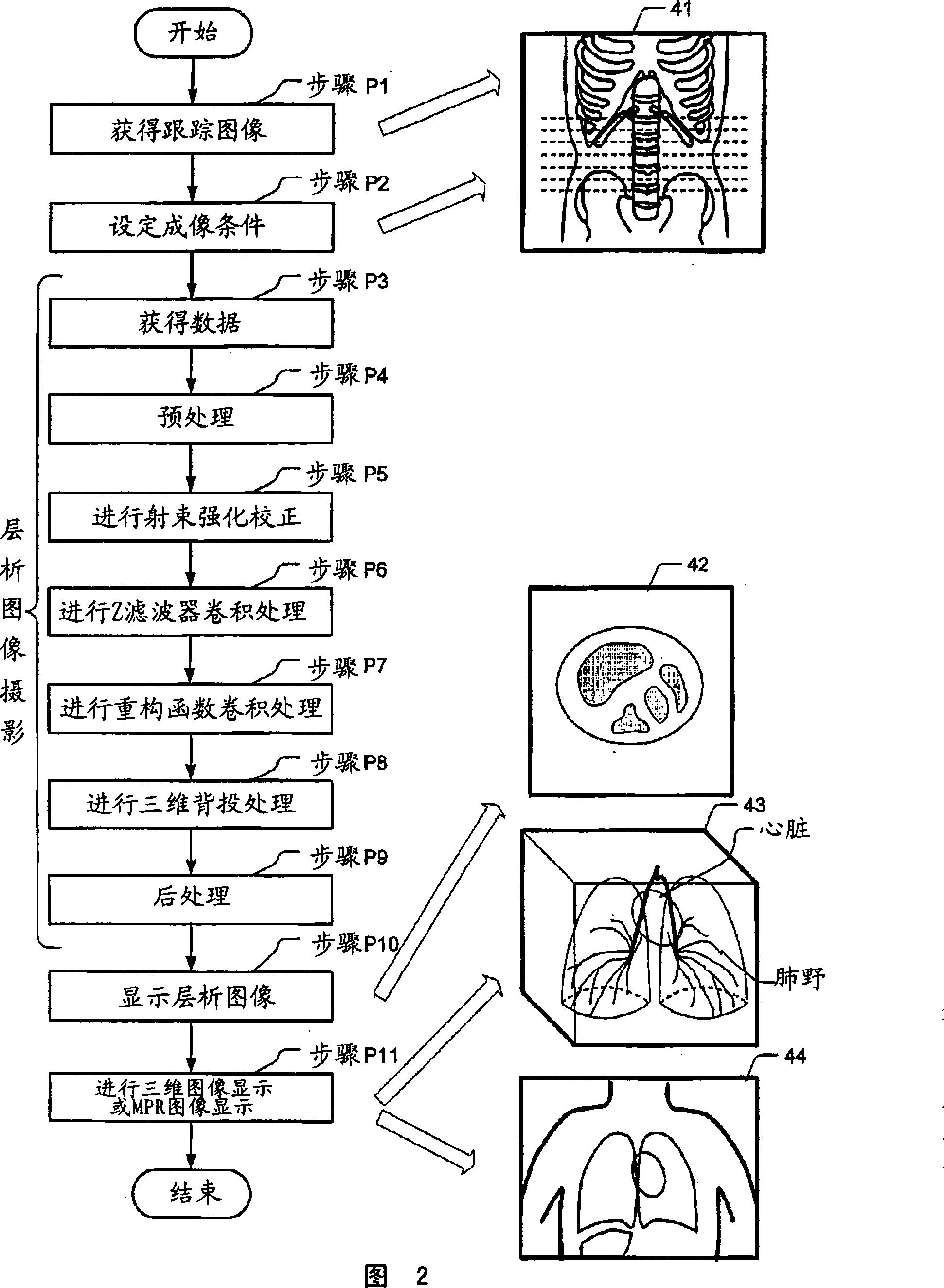 X-ray computed tomography apparatus