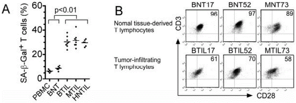 A method for preparing a drug for preventing tumor cells from inducing T cell aging and reversing its immunosuppressive ability and its use in anti-tumor immunotherapy