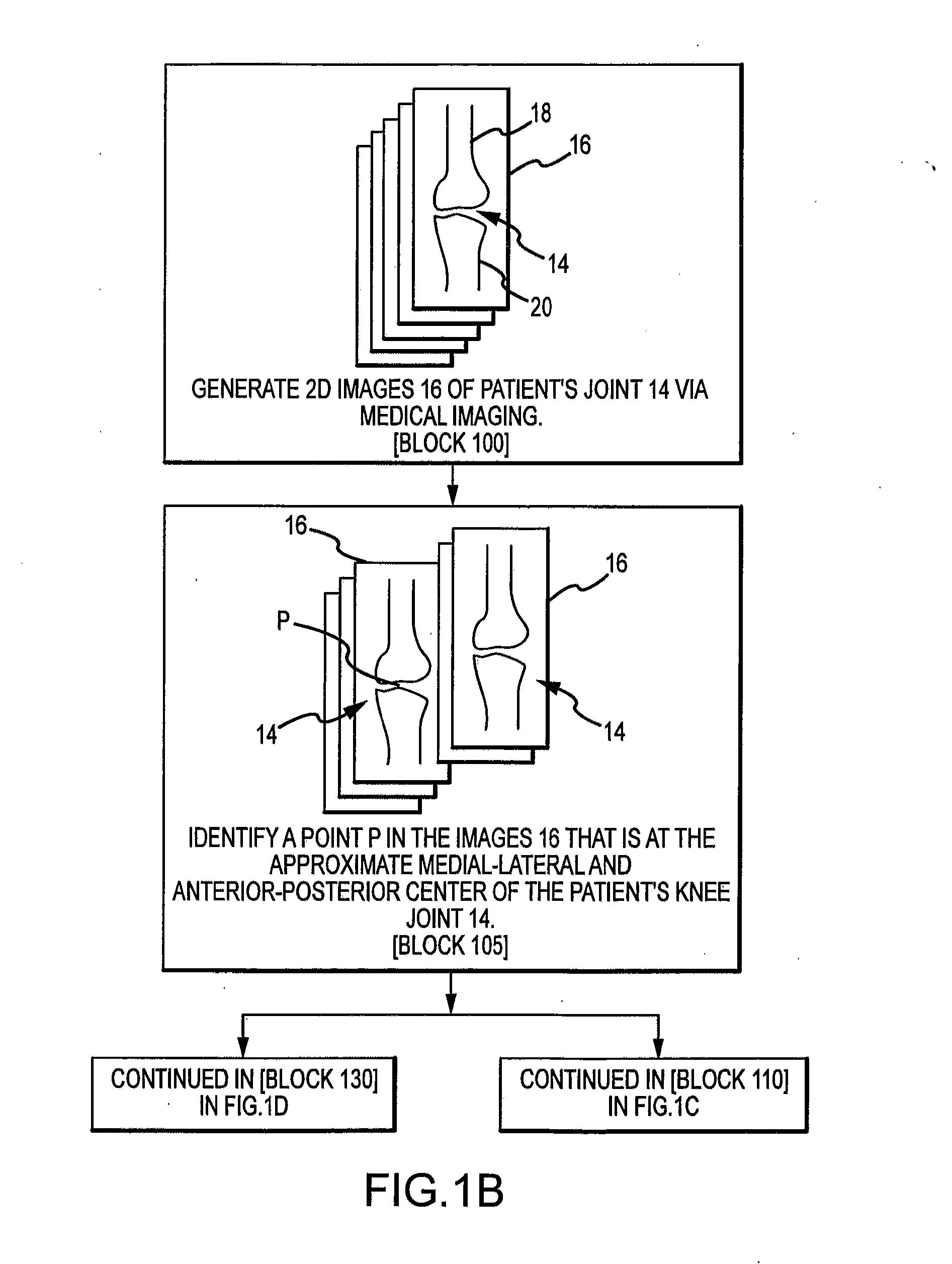 System and method for image segmentation in generating computer models of a joint to undergo arthroplasty