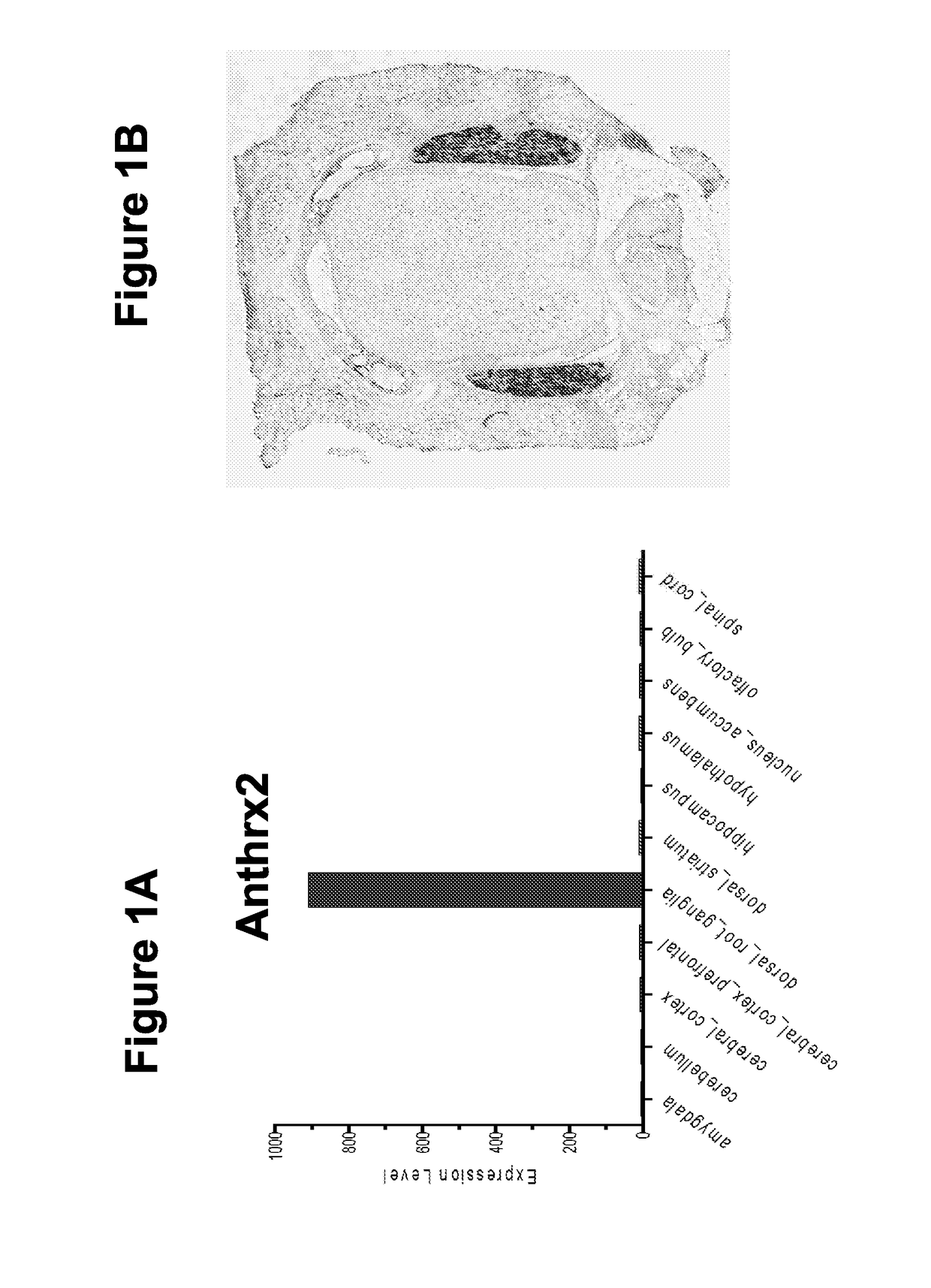 Compositions and methods for treatment of pain