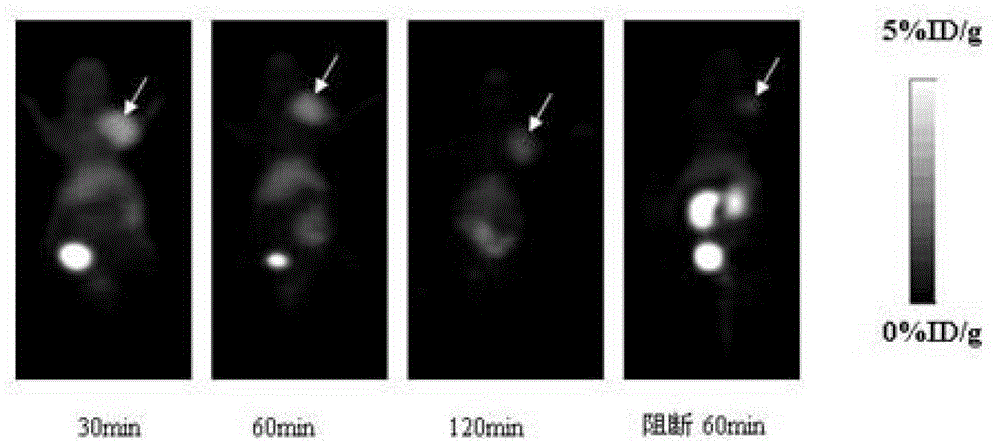 PET (Positron Emission Tomography) tracer with FSHR (Follicle-stimulating Hormone Receptor) targeting as well as preparation method and application thereof