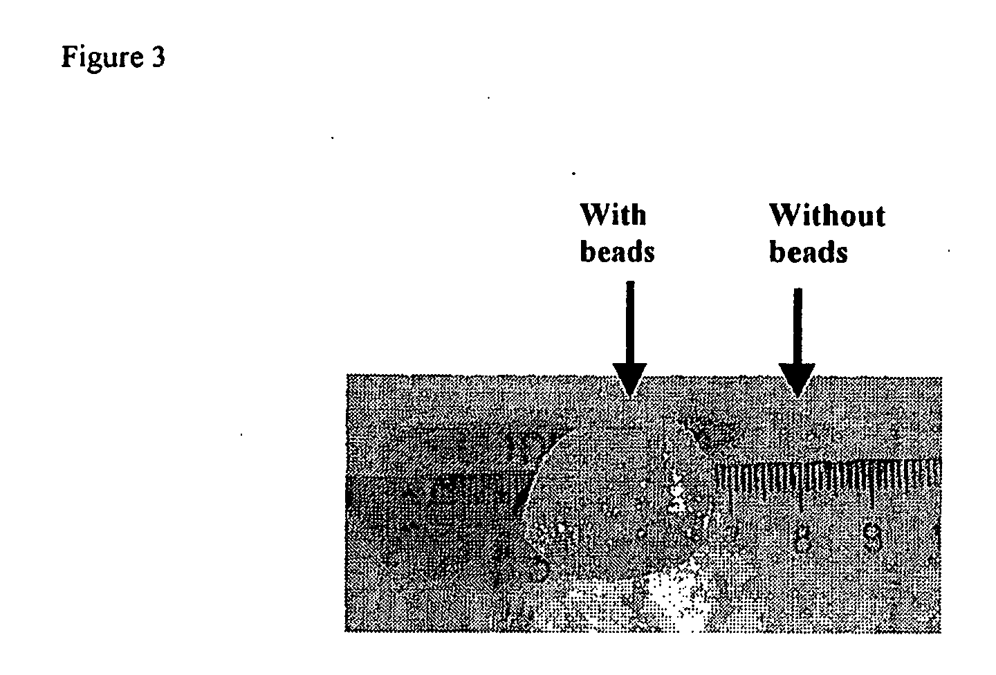 Methods and devices for tissue repair