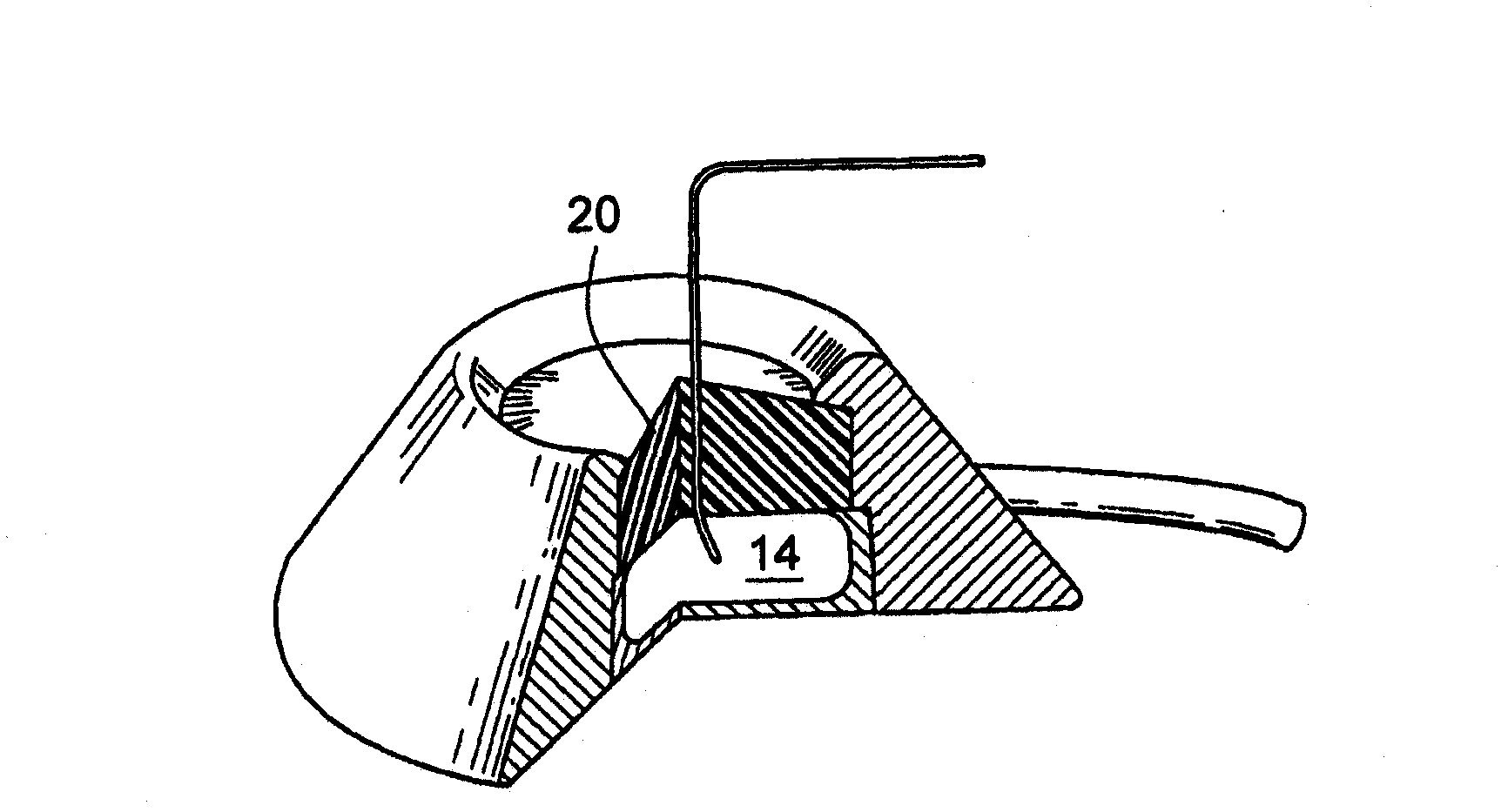 Needle for subcutaneous port