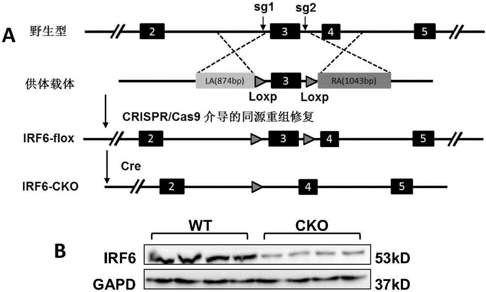 Interferon regulatory factor 6(IRF6) and application of inhibitor of factor in treatment of myocardial hypertrophy