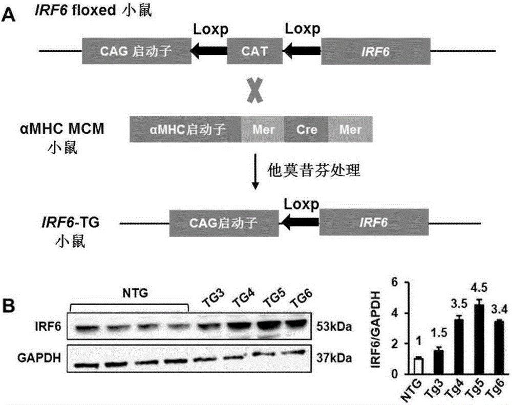 Interferon regulatory factor 6(IRF6) and application of inhibitor of factor in treatment of myocardial hypertrophy