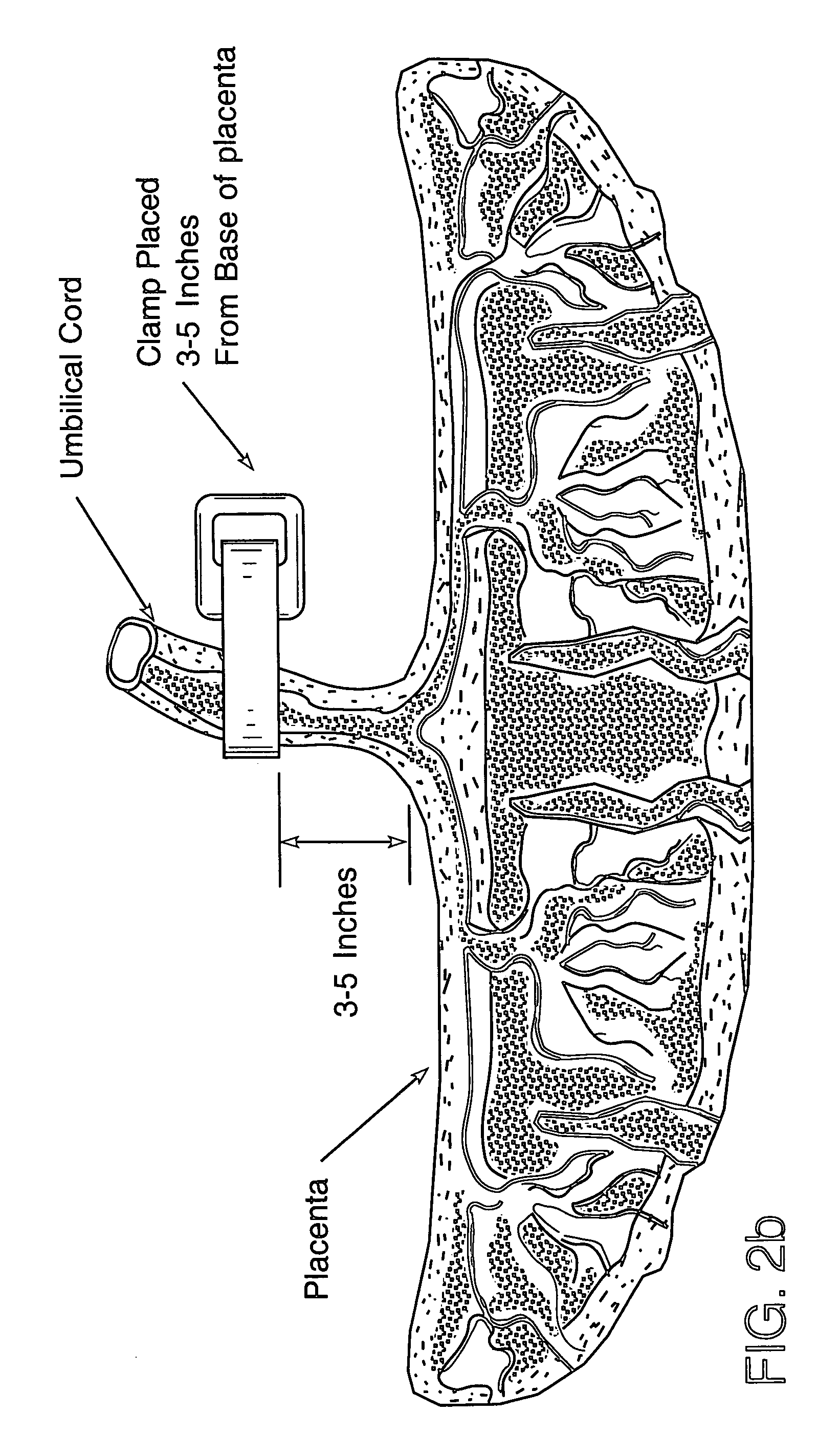 Method of collecting placental stem cells