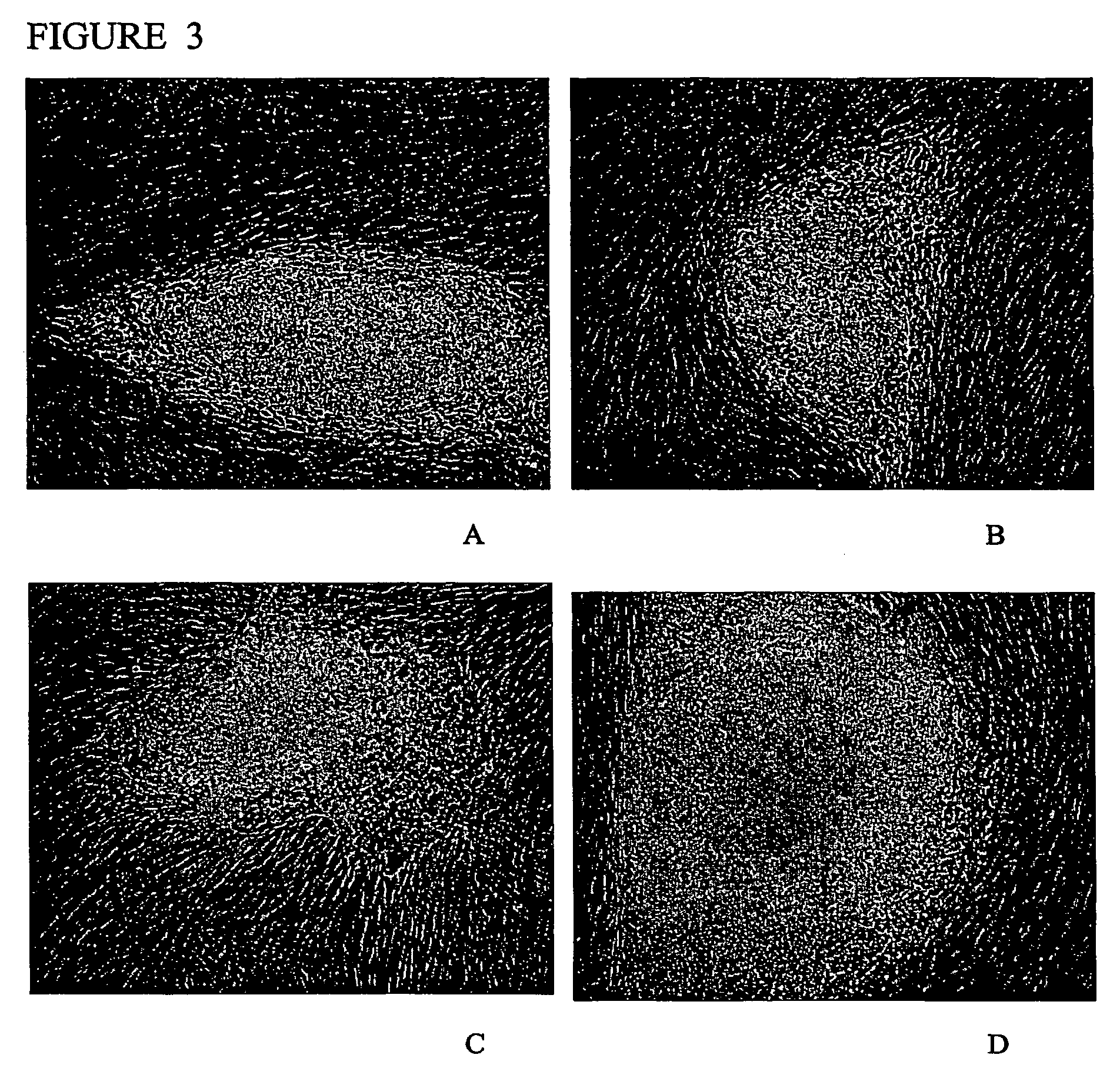 Methods for the culture of human embryonic stem cells on human feeder cells