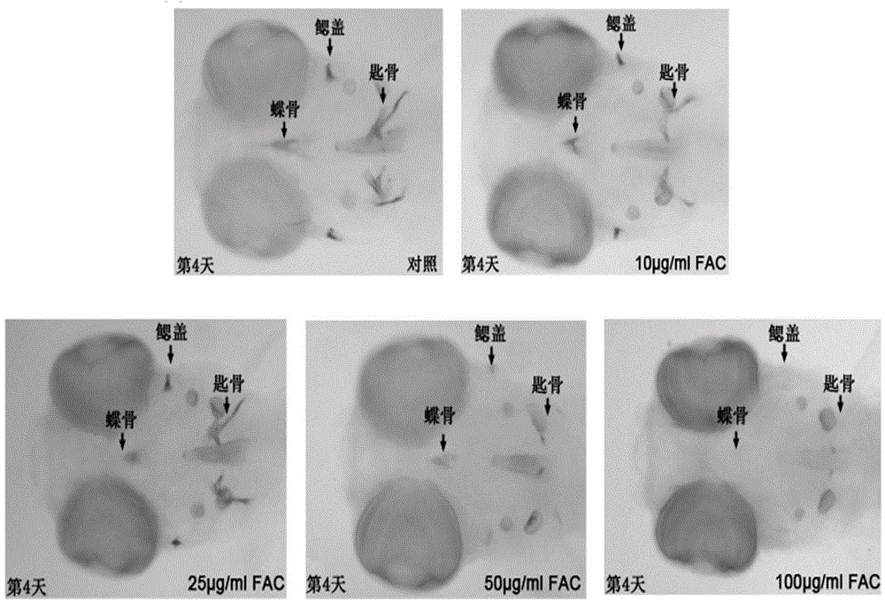 Construction method for zebra fish model using hepcidin to treat high-iron inhibition of bone formation